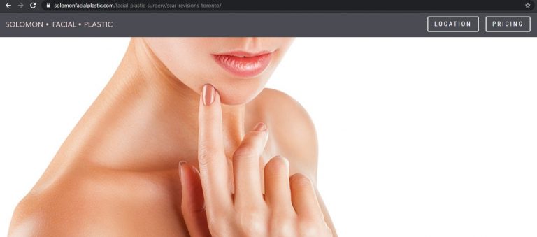 Solomon Facial Plastic included the keyword Scar Revision Toronto