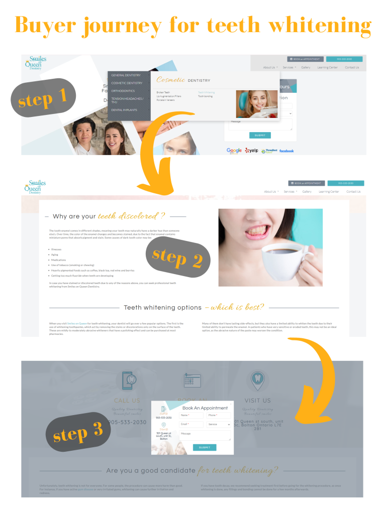 marketing for dentists: Buyer journey for teeth whitening