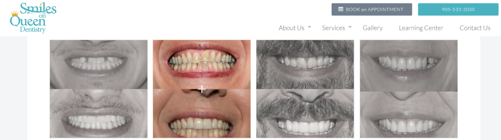 before and after dental advertisement - best dental marketing ideas